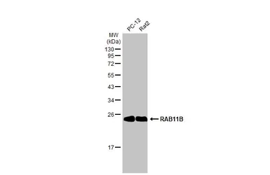 Anti-RAB11B antibody [N1C3] used in Western Blot (WB). GTX119095
