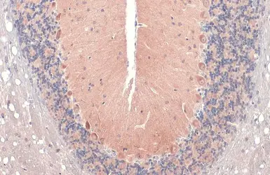 Anti-RAB11B antibody [N1C3] used in IHC (Paraffin sections) (IHC-P). GTX119095