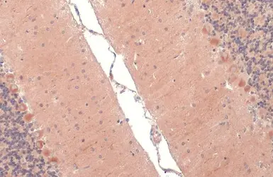 Anti-RAB11B antibody [N1C3] used in IHC (Paraffin sections) (IHC-P). GTX119095