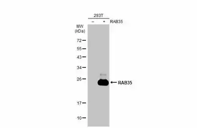Anti-RAB35 antibody [N1C3] used in Western Blot (WB). GTX120294