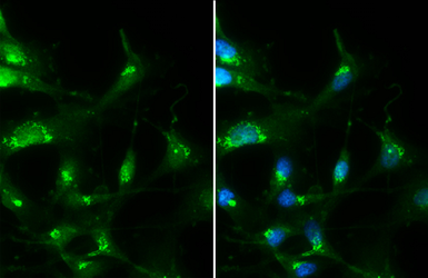 Anti-RAB35 antibody [N1C3] used in Immunocytochemistry/ Immunofluorescence (ICC/IF). GTX120294
