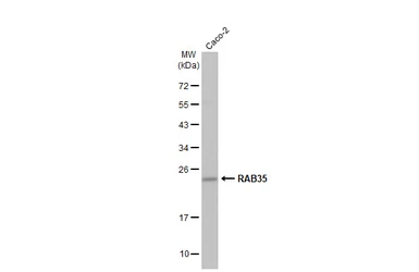 Anti-RAB35 antibody [N1C3] used in Western Blot (WB). GTX120294