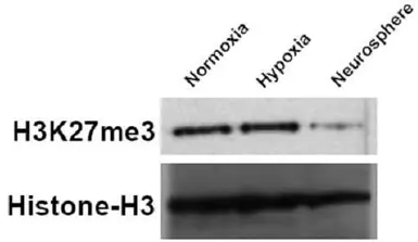 Anti-Histone H3K27me3 (Tri-methyl Lys27) antibody used in Western Blot (WB). GTX121184