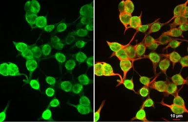 Anti-Histone H3K27me3 (Tri-methyl Lys27) antibody used in Immunocytochemistry/ Immunofluorescence (ICC/IF). GTX121184
