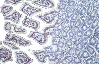 Anti-Histone H3K27me3 (Tri-methyl Lys27) antibody used in IHC (Paraffin sections) (IHC-P). GTX121184