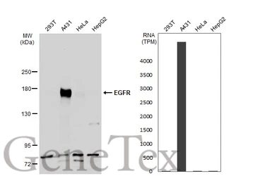 Anti-EGFR antibody [N1-2], N-term used in Western Blot (WB). GTX121919