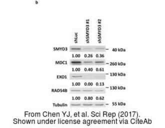 Anti-SMYD3 antibody used in Western Blot (WB). GTX121945
