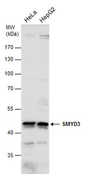 Anti-SMYD3 antibody used in Western Blot (WB). GTX121945