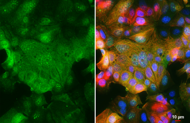 Anti-SMYD3 antibody used in Immunocytochemistry/ Immunofluorescence (ICC/IF). GTX121945