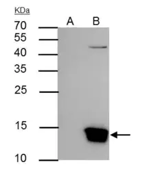 Anti-Histone H3 antibody used in Immunoprecipitation (IP). GTX122148