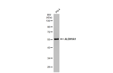 Anti-ALDH1A1 antibody used in Western Blot (WB). GTX123973