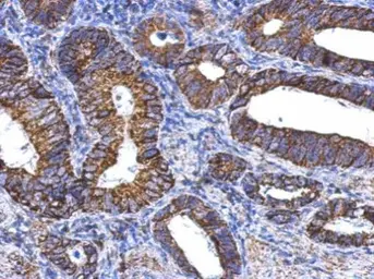 Anti-ALDH1A1 antibody used in IHC (Paraffin sections) (IHC-P). GTX123973