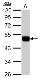 Anti-ALDH1A1 antibody used in Western Blot (WB). GTX123973