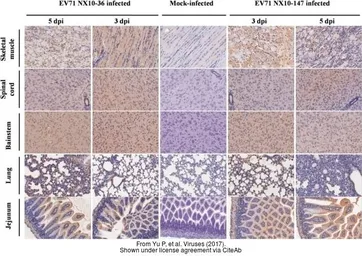 Anti-Enterovirus 71 antibody used in IHC (Paraffin sections) (IHC-P). GTX124261