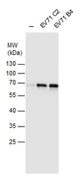 Anti-Enterovirus 71 antibody used in Western Blot (WB). GTX124261