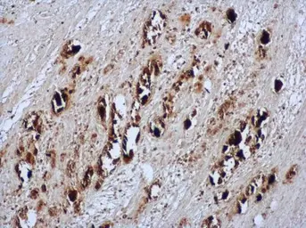 Anti-Enterovirus 71 antibody used in IHC (Paraffin sections) (IHC-P). GTX124261