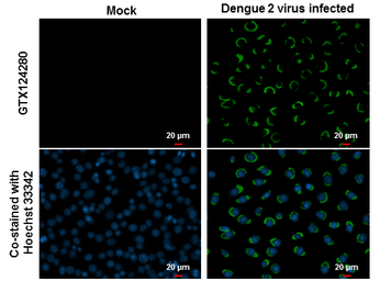 Anti-Dengue virus NS1 protein antibody used in Immunocytochemistry/ Immunofluorescence (ICC/IF). GTX124280