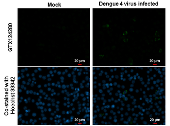 Anti-Dengue virus NS1 protein antibody used in Immunocytochemistry/ Immunofluorescence (ICC/IF). GTX124280