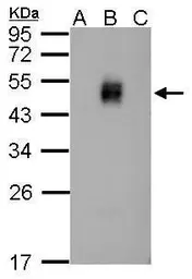 Anti-Dengue virus NS1 protein antibody used in Western Blot (WB). GTX124280