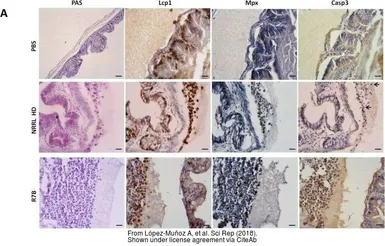 Anti-Lcp1 antibody used in  (). GTX124420