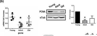 Anti-Pcna antibody used in Western Blot (WB). GTX124496