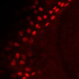 Anti-Tp63 antibody used in  (). GTX124660