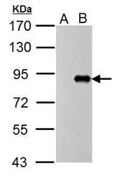 Anti-Influenza A virus PB1 protein antibody used in Western Blot (WB). GTX125923