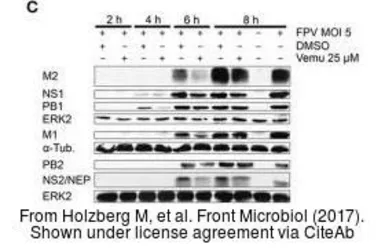 Anti-Influenza A virus NS2 / NEP antibody used in Western Blot (WB). GTX125953