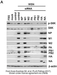 Anti-Influenza A virus H1N1 NA (Neuraminidase) antibody used in Western Blot (WB). GTX125974