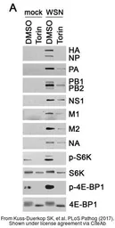 Anti-Influenza A virus H1N1 NA (Neuraminidase) antibody used in Western Blot (WB). GTX125974