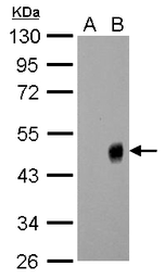 Anti-Influenza A virus H1N1 NA (Neuraminidase) antibody used in Western Blot (WB). GTX125974
