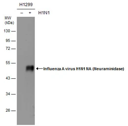Anti-Influenza A virus H1N1 NA (Neuraminidase) antibody used in Western Blot (WB). GTX125974