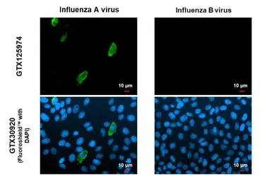 Anti-Influenza A virus H1N1 NA (Neuraminidase) antibody used in Immunocytochemistry/ Immunofluorescence (ICC/IF). GTX125974