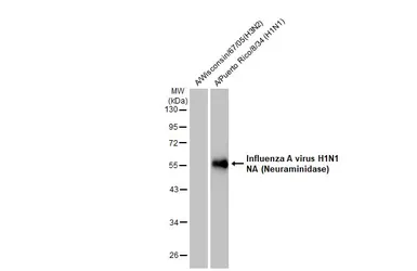 Anti-Influenza A virus H1N1 NA (Neuraminidase) antibody used in Western Blot (WB). GTX125974