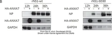 Anti-Influenza A virus Nucleoprotein antibody used in Western Blot (WB). GTX125989