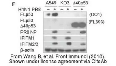 Anti-Influenza A virus Nucleoprotein antibody used in Western Blot (WB). GTX125989