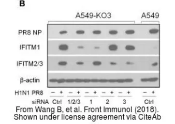 Anti-Influenza A virus Nucleoprotein antibody used in Western Blot (WB). GTX125989