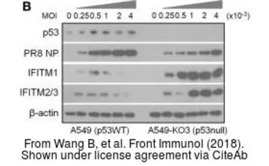 Anti-Influenza A virus Nucleoprotein antibody used in Western Blot (WB). GTX125989