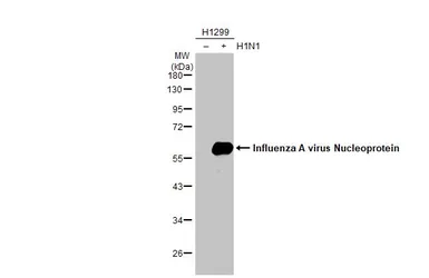 Anti-Influenza A virus Nucleoprotein antibody used in Western Blot (WB). GTX125989