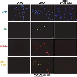 Anti-HIF1 alpha antibody used in Immunocytochemistry/ Immunofluorescence (ICC/IF). GTX127309