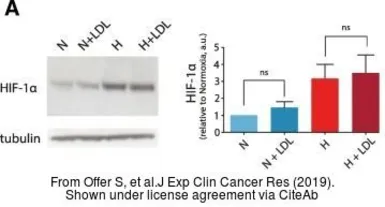 Anti-HIF1 alpha antibody used in Western Blot (WB). GTX127309