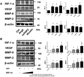 Anti-HIF1 alpha antibody used in Western Blot (WB). GTX127309