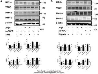 Anti-HIF1 alpha antibody used in Western Blot (WB). GTX127309