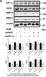 Anti-HIF1 alpha antibody used in Western Blot (WB). GTX127309