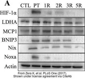 Anti-HIF1 alpha antibody used in Western Blot (WB). GTX127309