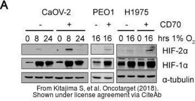 Anti-HIF1 alpha antibody used in Western Blot (WB). GTX127309