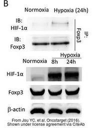 Anti-HIF1 alpha antibody used in Western Blot (WB). GTX127309