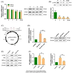 Anti-HIF1 alpha antibody used in Western Blot (WB). GTX127309