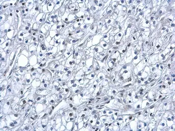 Anti-HIF1 alpha antibody used in IHC (Paraffin sections) (IHC-P). GTX127309