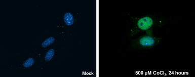 Anti-HIF1 alpha antibody used in Immunocytochemistry/ Immunofluorescence (ICC/IF). GTX127309